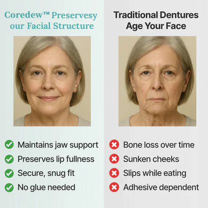 ✨Ends Today: 70% OFF! Coredew™⏰ Custom-Fit Full Functional Dentures Make you more confident